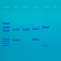 PCR 유전자 지문분석